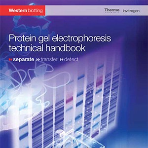 protein-gel-electrophoresis protein-gel-electrophoresis